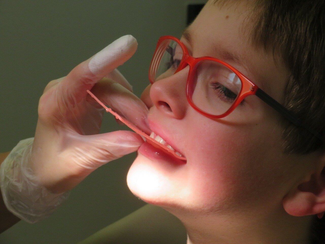 leczenie zębów u dzieci