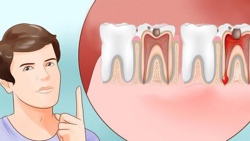 Co jest dobra ne ból zęba - sposoby