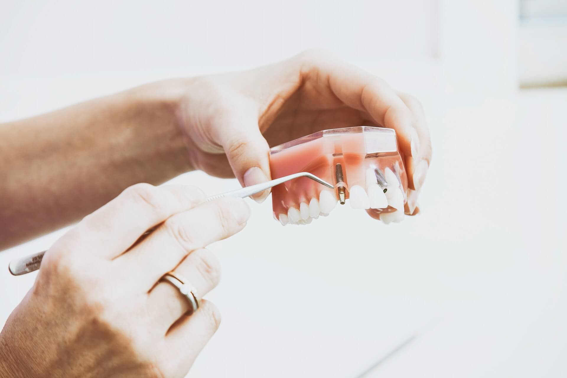 proteza na implantach