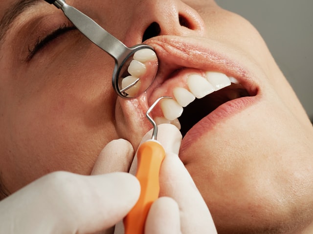 Ogniska siejące w stomatologii - co to takiego?