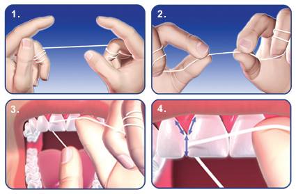 Instrukcja używania nitki do zębów