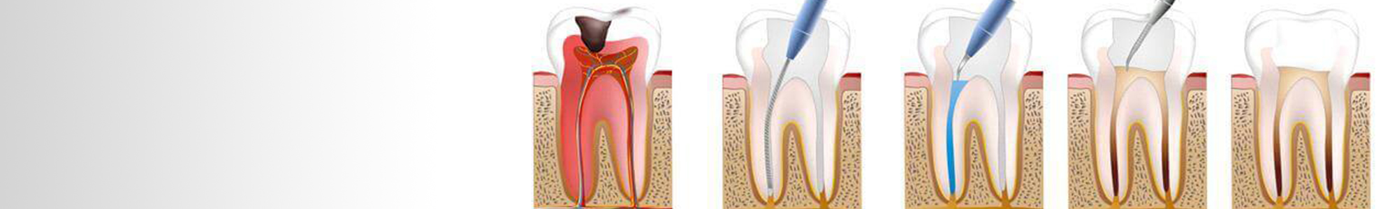 Endodoncja