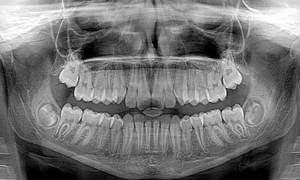 Rentgenodiagnostyka