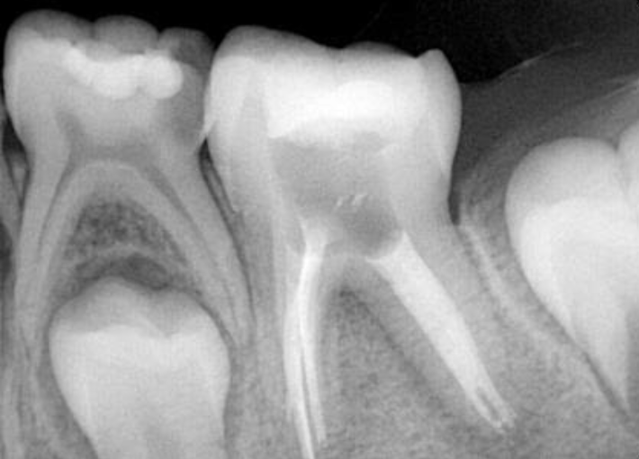 Rentgenodiagnostyka