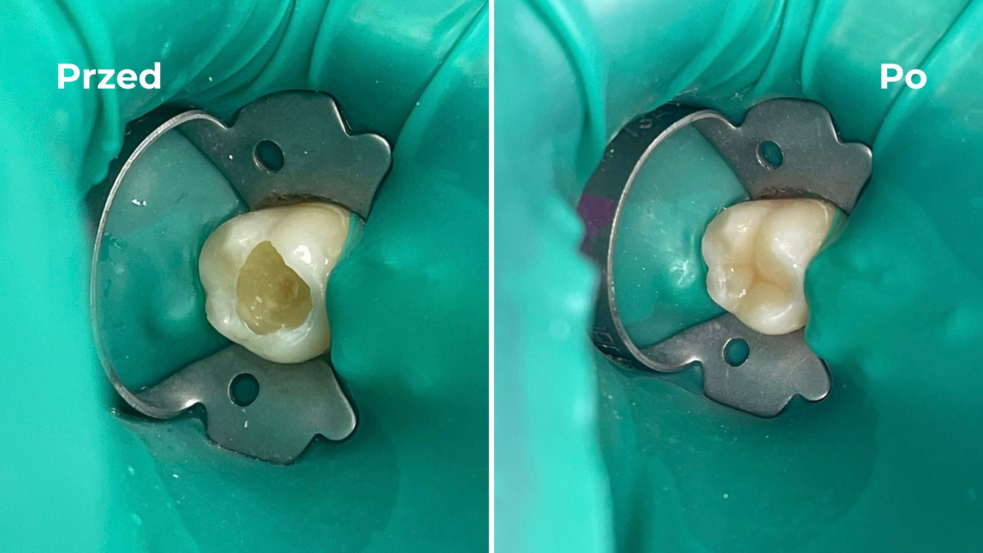 Stomatologia Zachowawcza Allecoudent