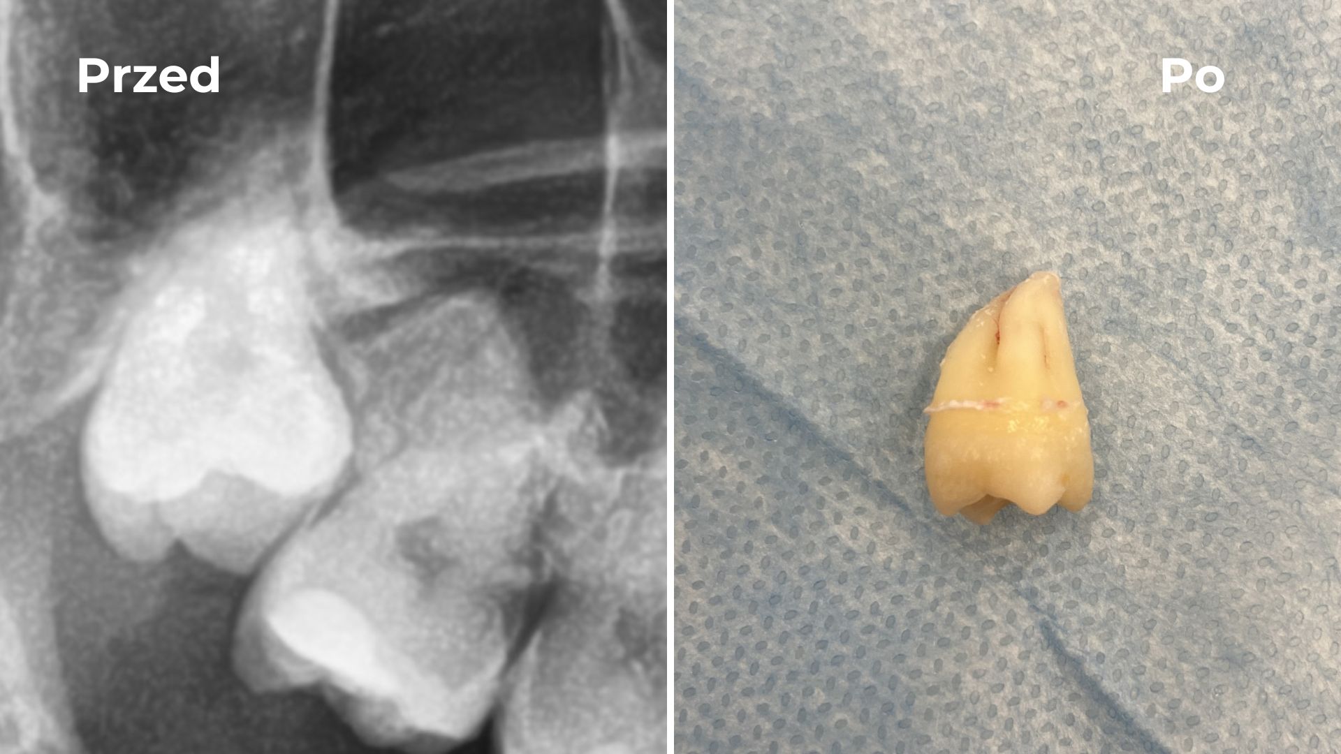 Chirurgia Stomatologiczna Allecoudent