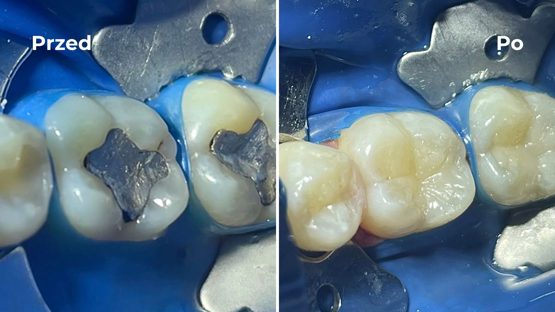 Stomatologia Zachowawcza Allecoudent