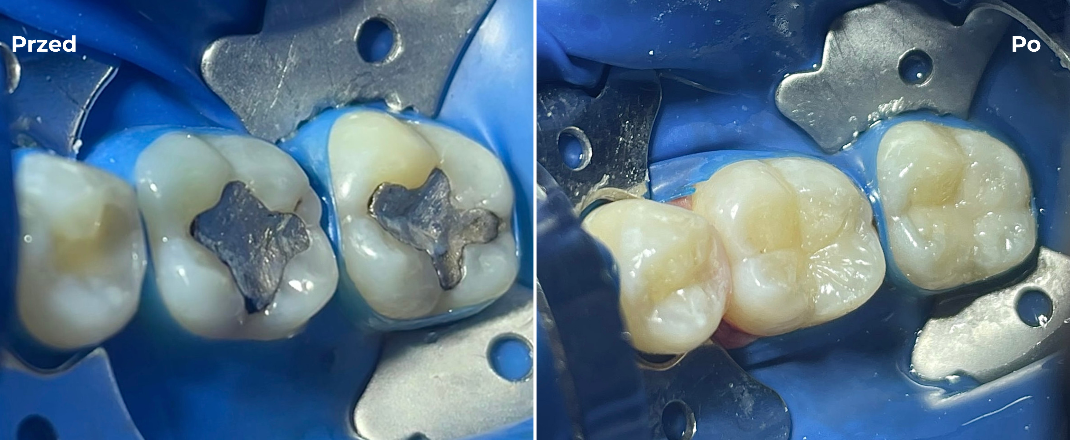 Stomatologia zachowawcza