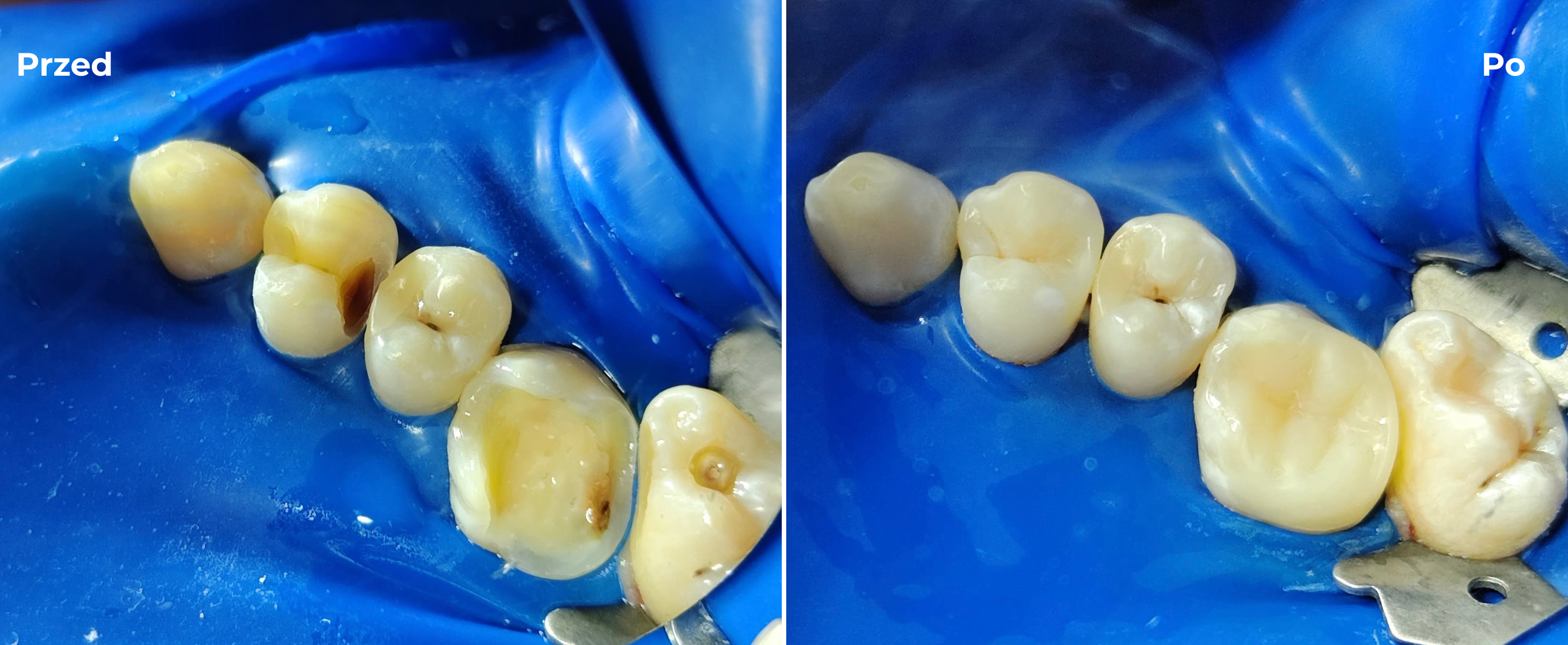Stomatologia zachowawcza