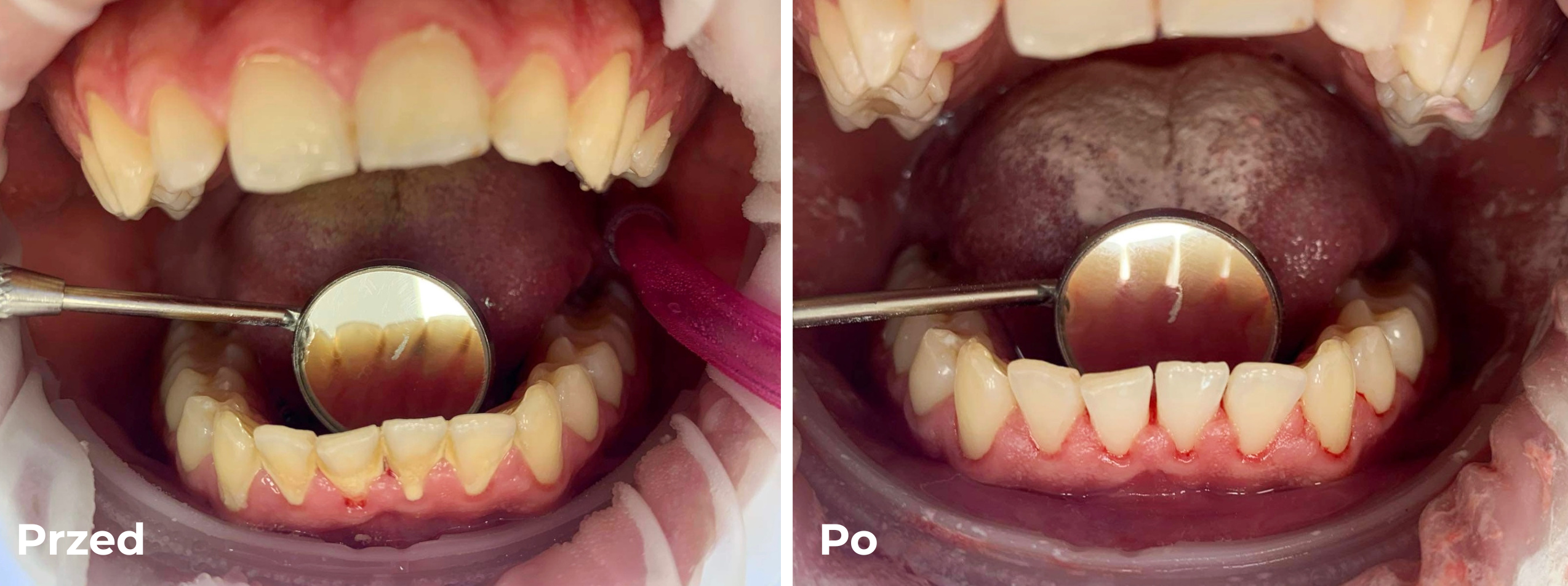Endodoncja