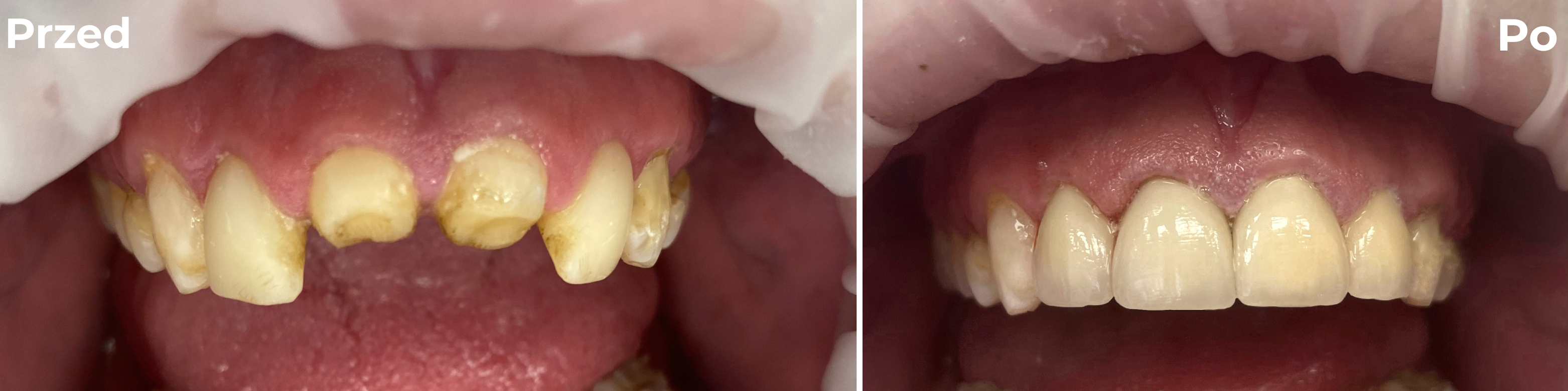 Stomatologia zachowawcza