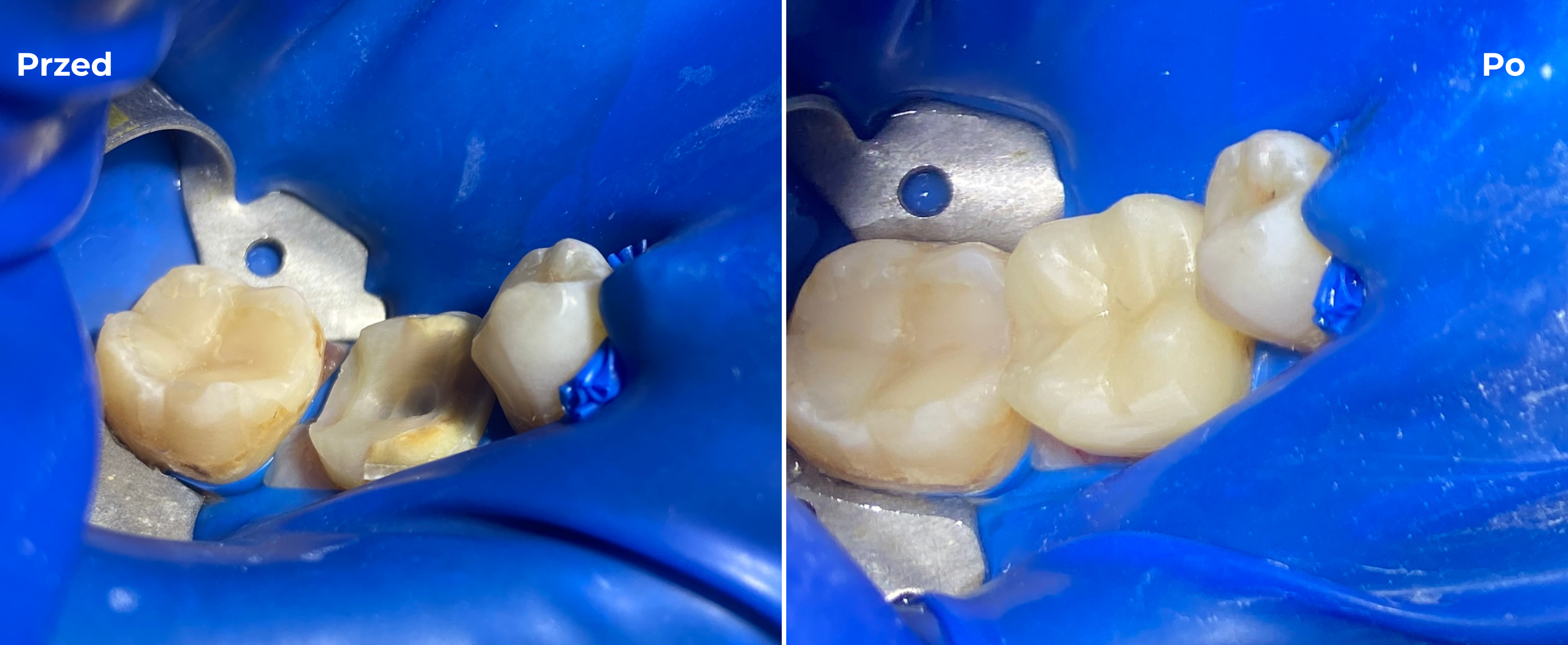 Stomatologia zachowawcza