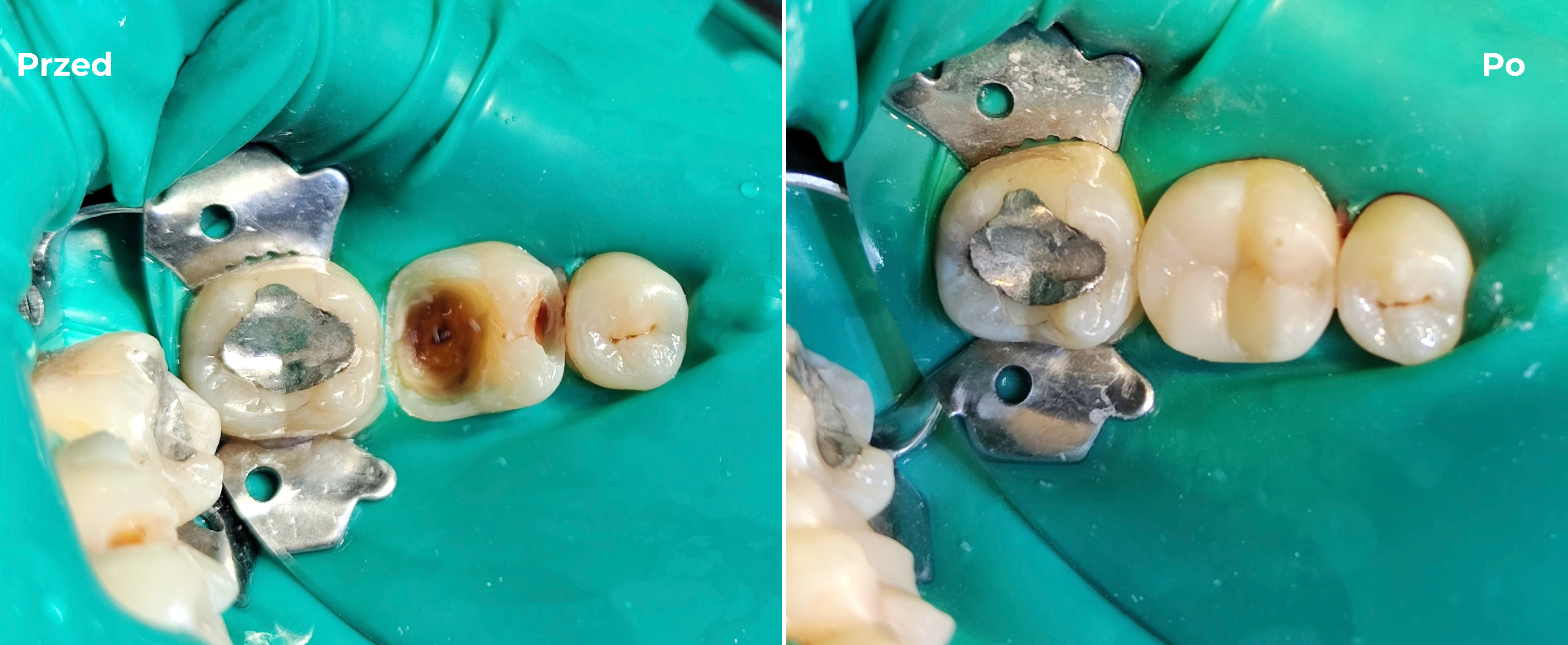 Stomatologia zachowawcza
