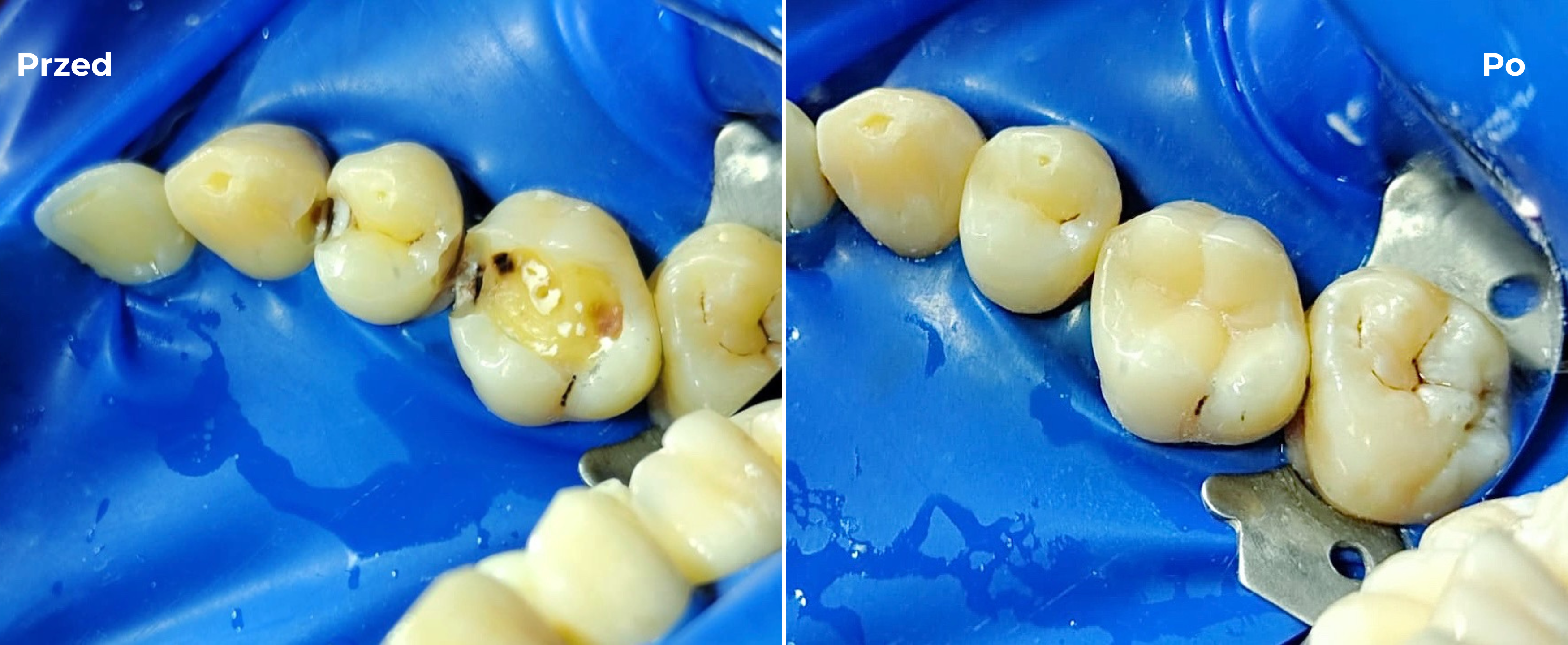 Stomatologia zachowawcza