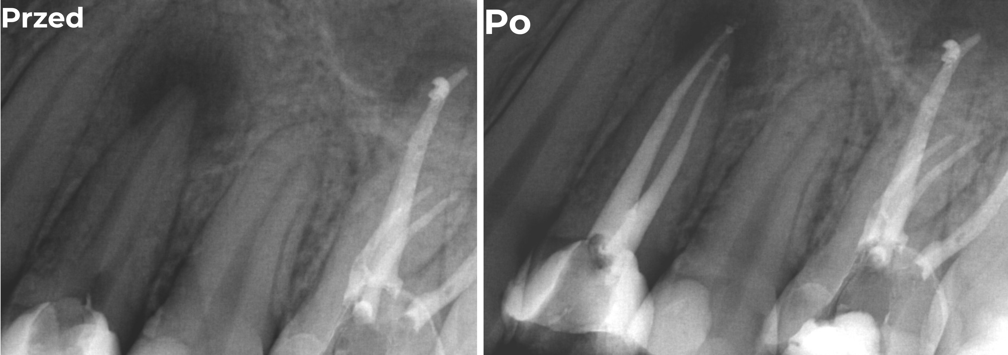 Endodoncja