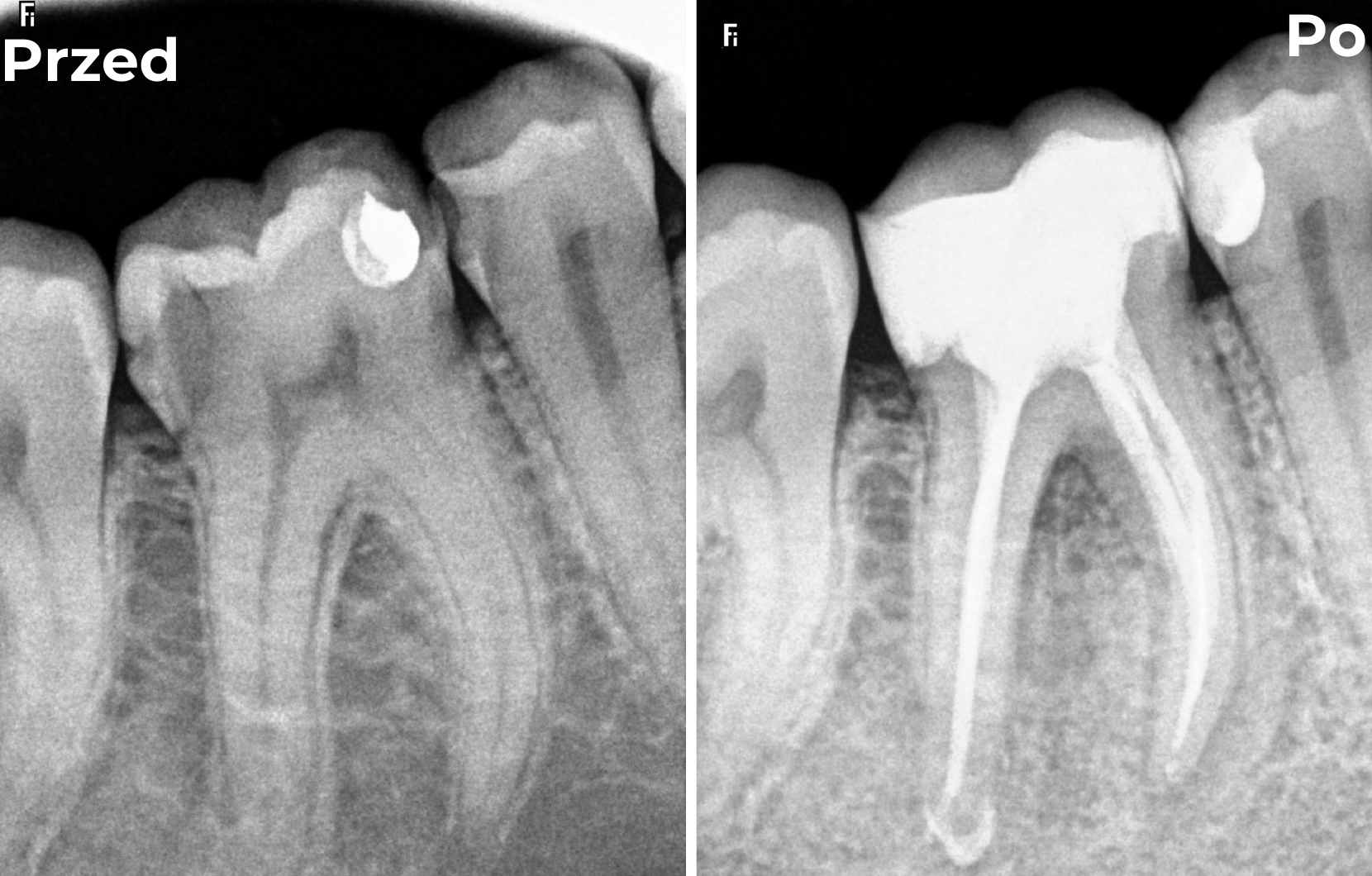 Endodoncja