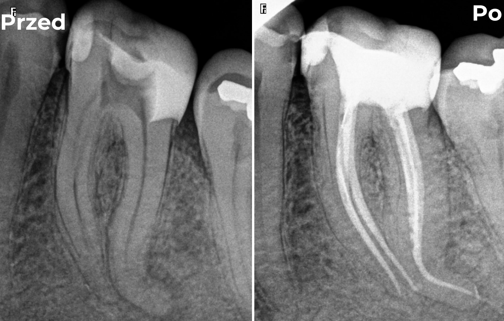 Endodoncja
