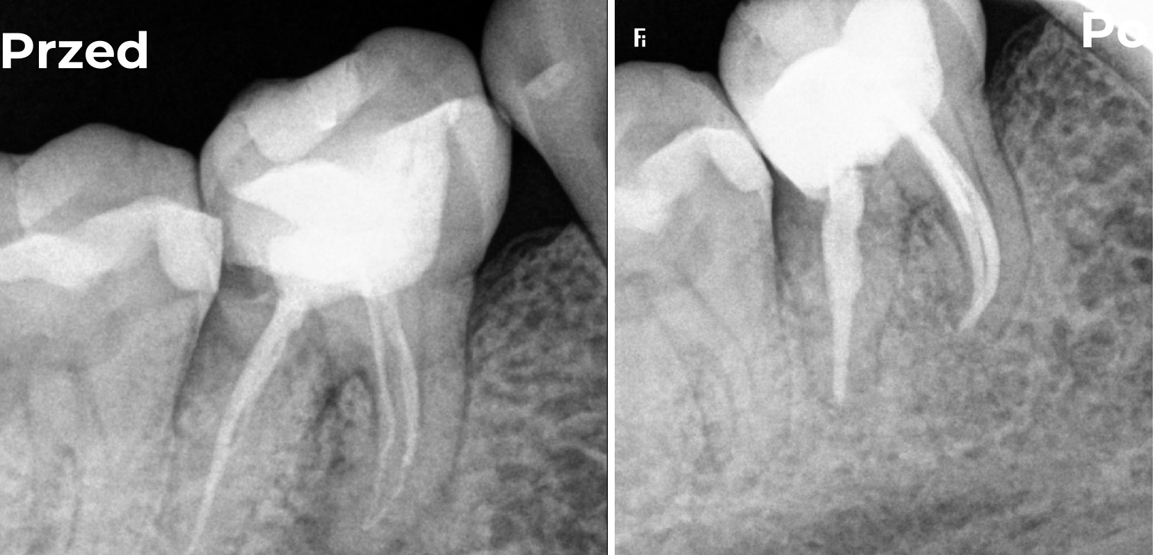 Endodoncja
