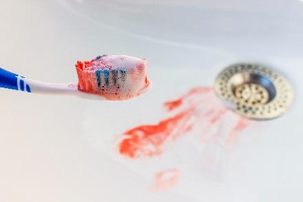 krwawienie podczas mycia zębów