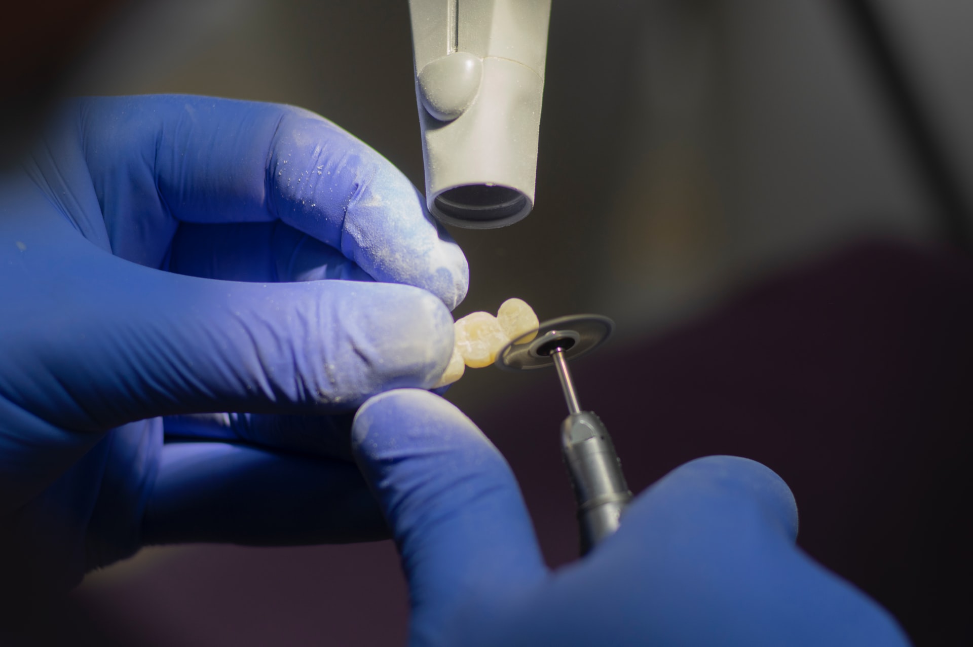 Szkieletowa proteza zębowa klamrowa i bezklamrowa