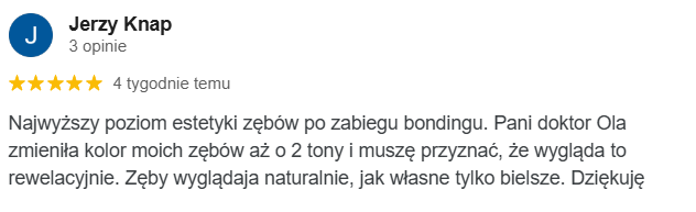 Opinia google Allecoudent - Bonding