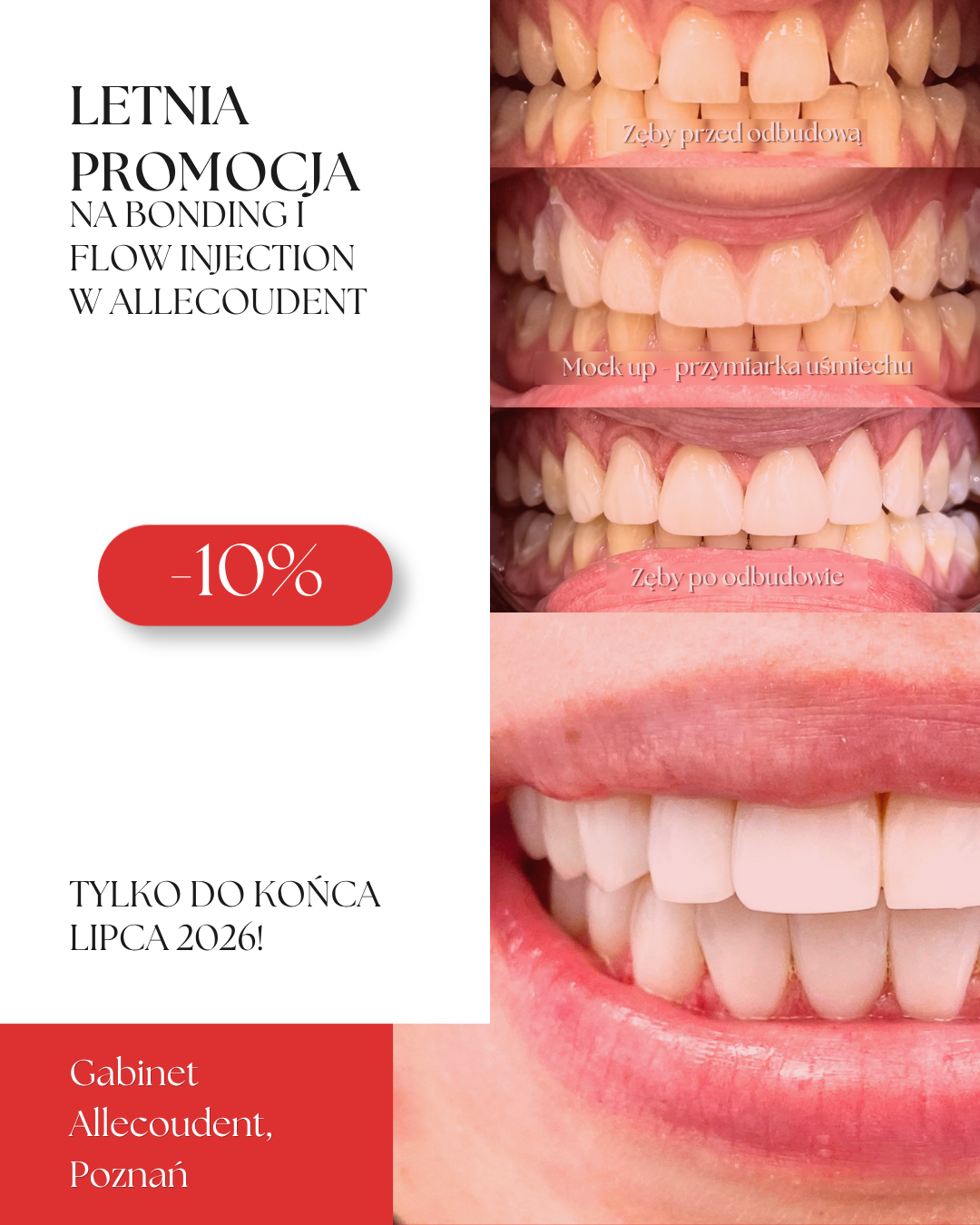 Nowy uśmiech na lato? Teraz w promocji!
