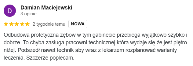 Opinia google Allecoudent - Protetyka